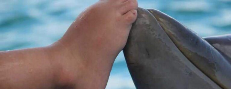 curacao dolphin herapy center